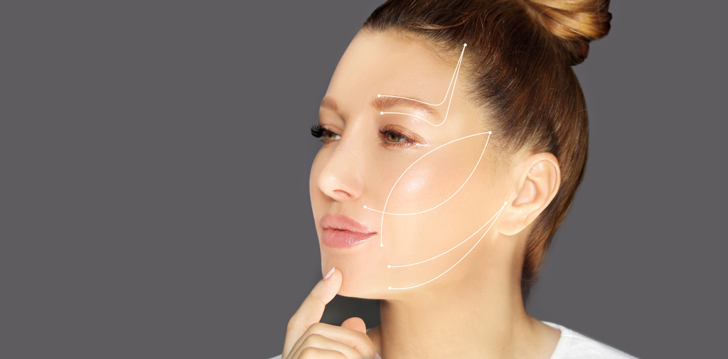 Rosto de mulher com marcações para cirurgia facial.