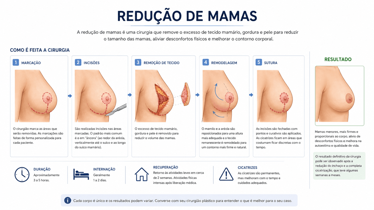 Como Saber se Você Precisa de Uma Cirurgia de Redução de Mamas?