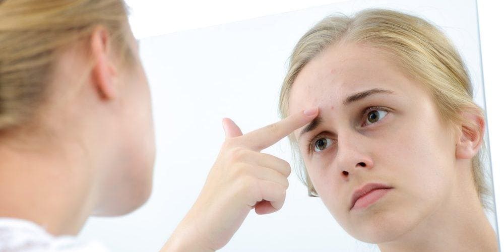 Conheça os principais tratamentos para acne