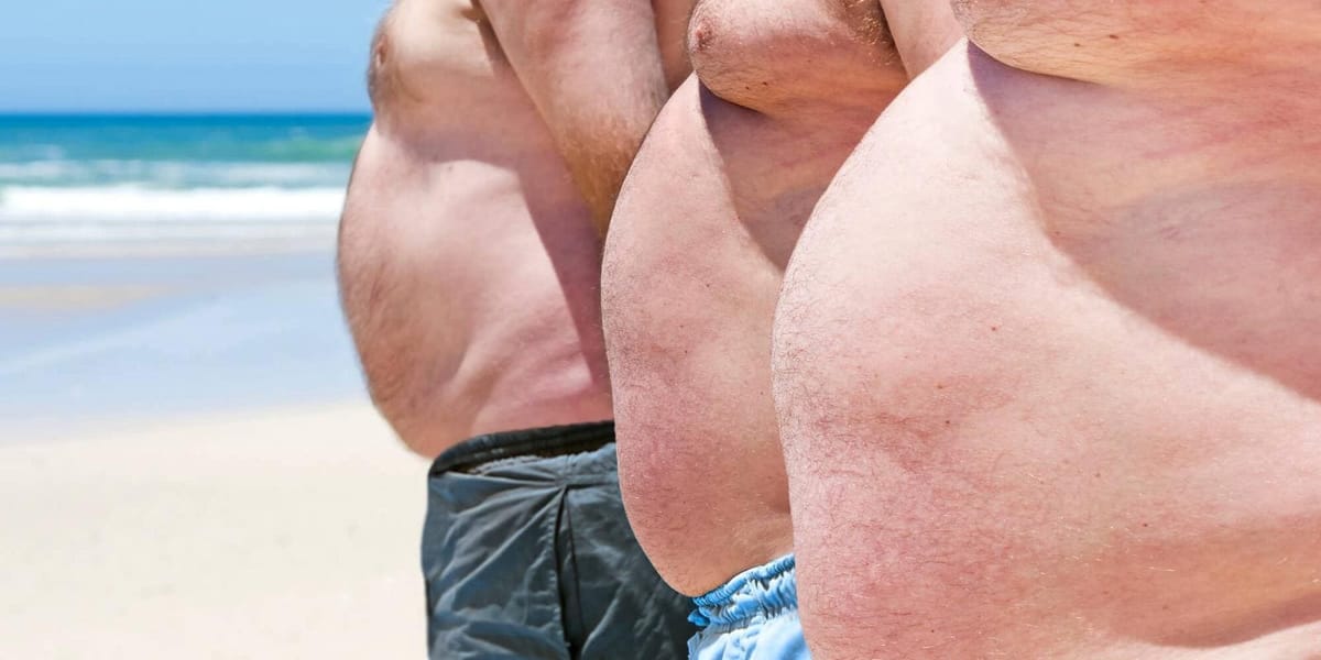 O que você precisa saber sobre a ginecomastia
