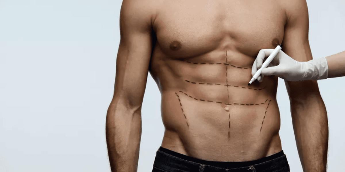 Como se preparar para uma Lipo HD?