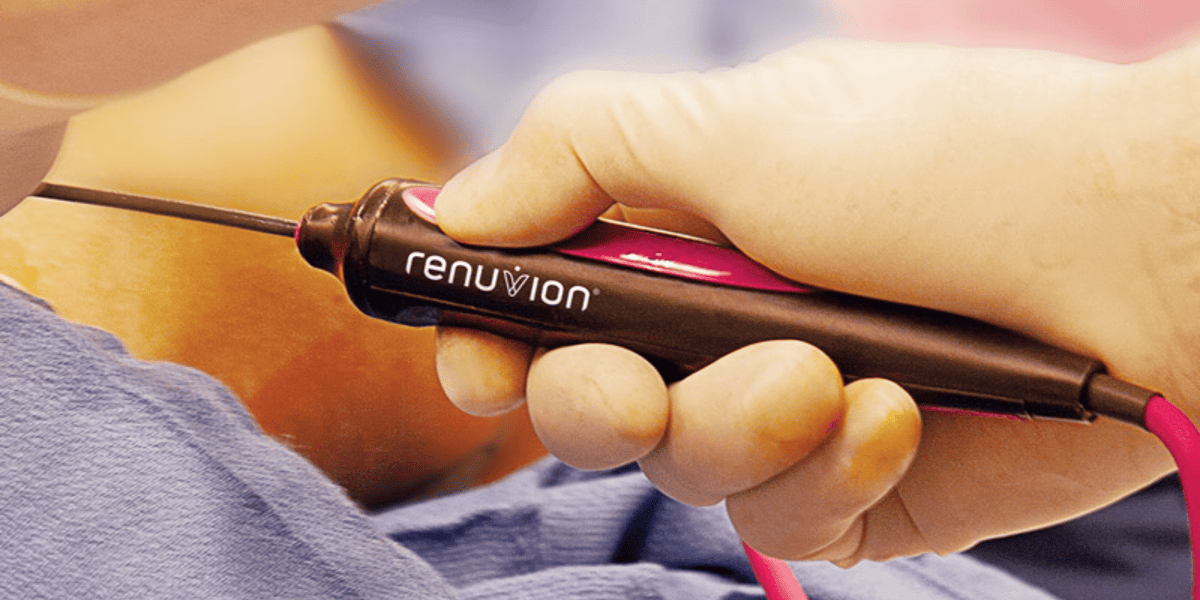 Renuvion: a tecnologia mais avançada no combate à flacidez da pele
