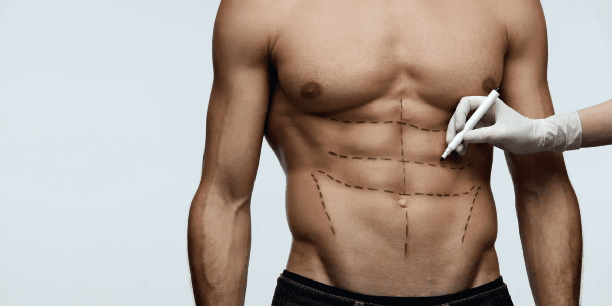 Toda Lipo HD gera o mesmo resultado? O que influencia no resultado? 