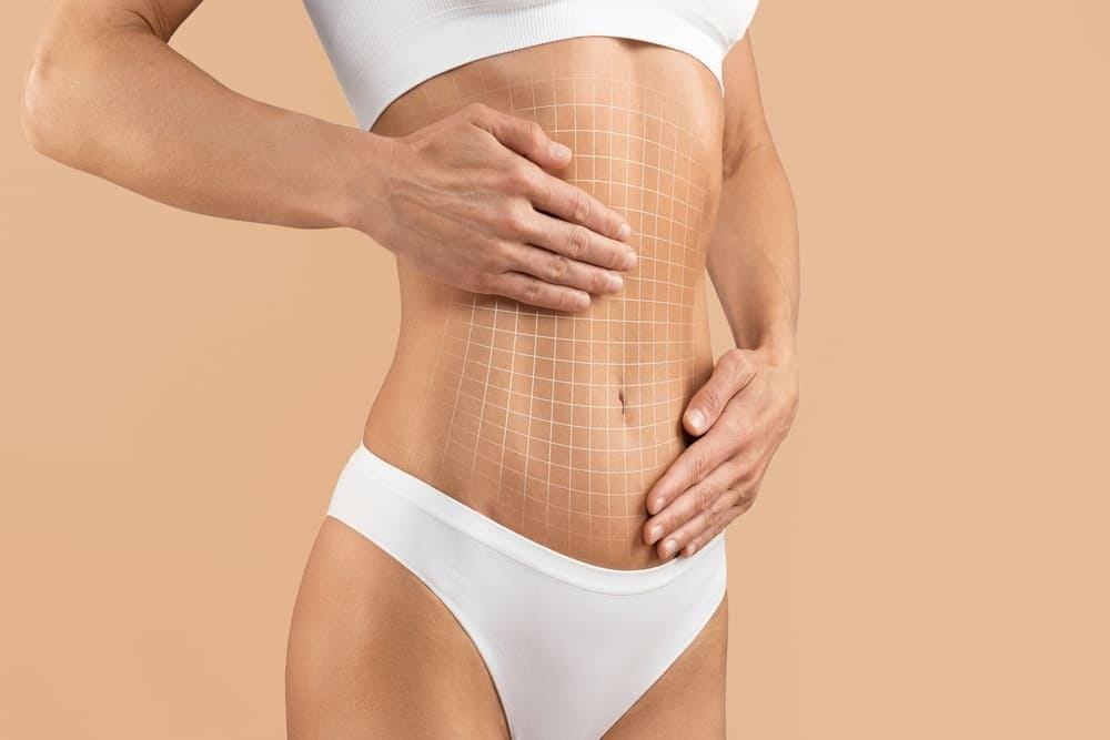 Saiba tudo sobre o procedimento de Lipo LAD