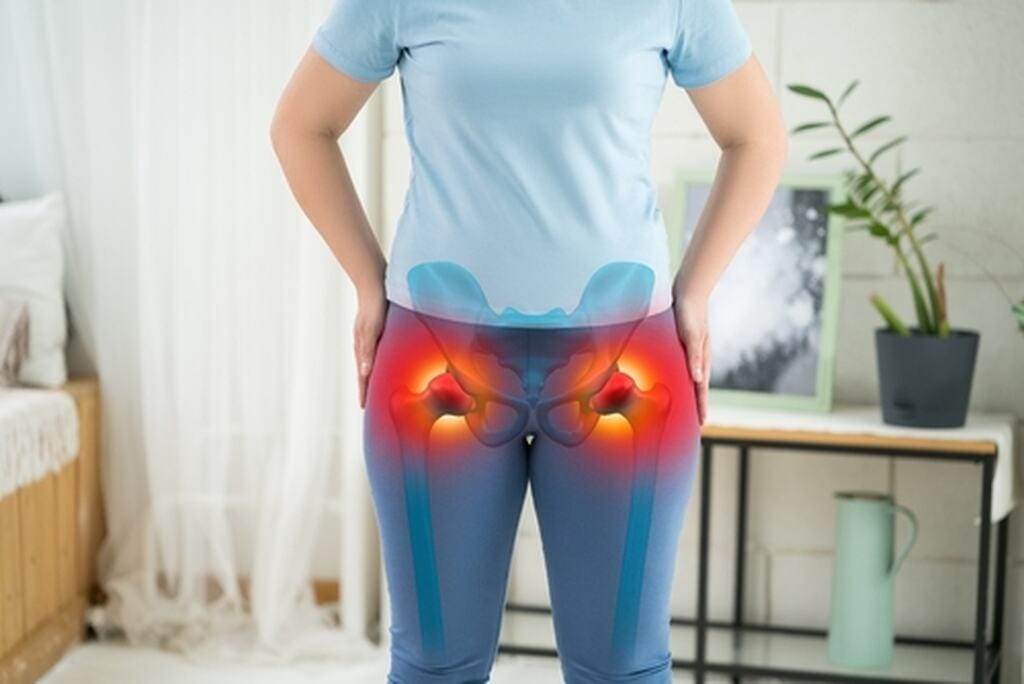 Hip dips: quais as causas e como corrigir a depressão trocantérica