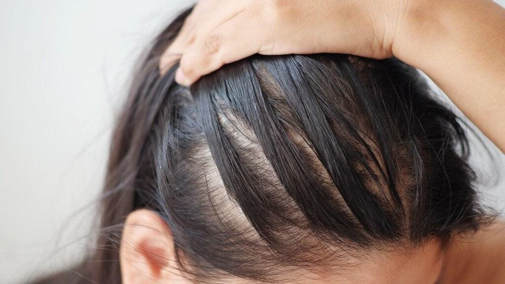 Queda de cabelo na menopausa: como reverter?