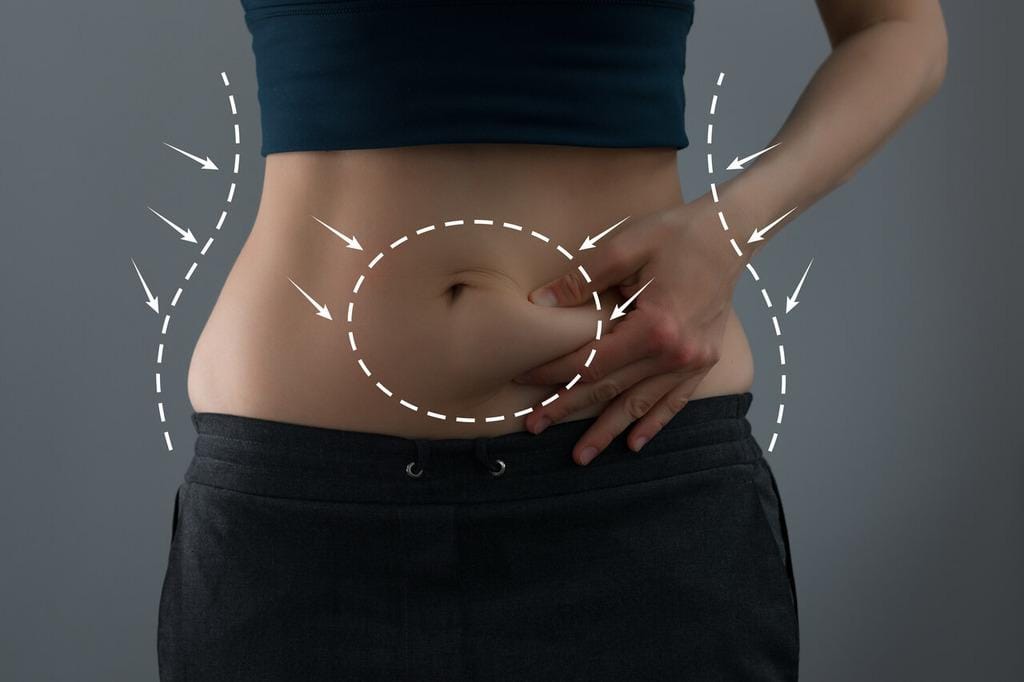 Cicatriz de abdominoplastia: confira quais são os cuidados necessários!