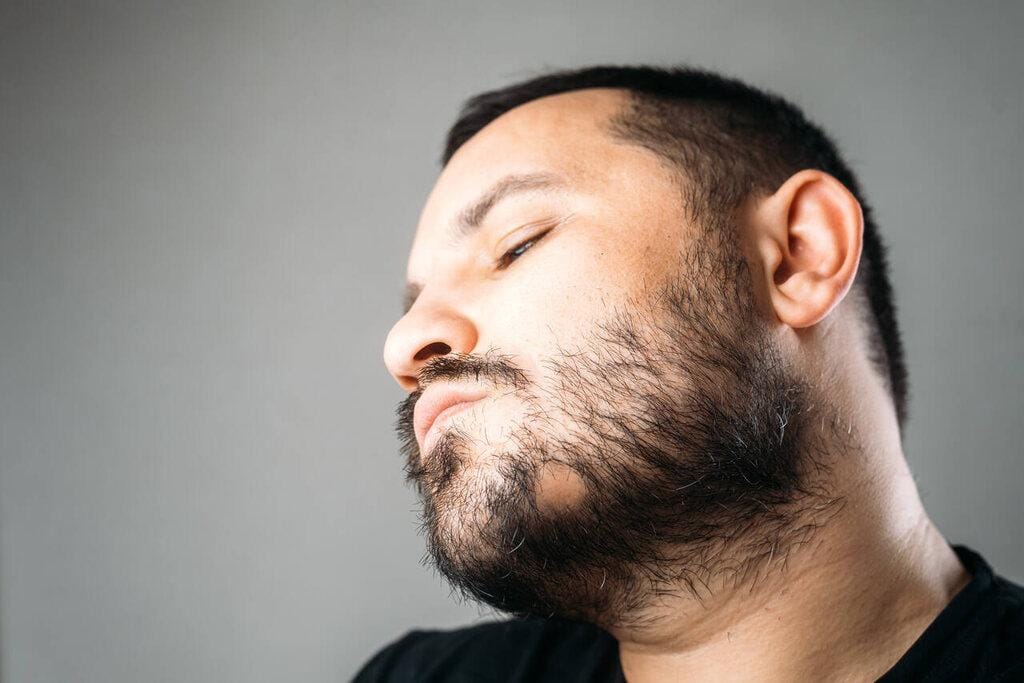 Quanto custa um transplante de barba em 2025? Confira
