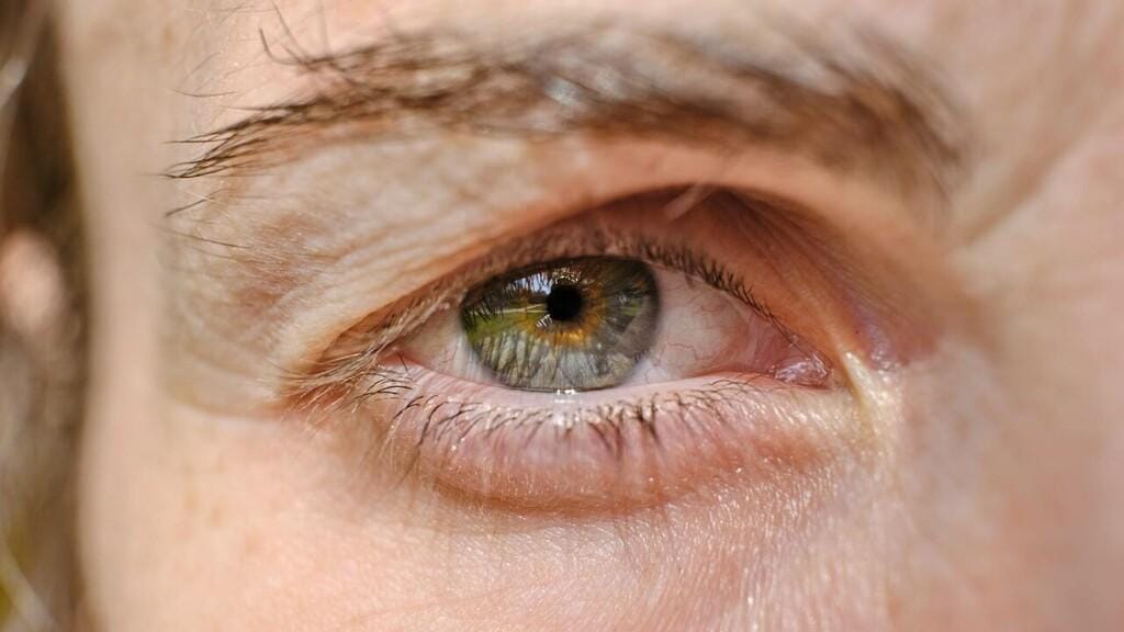 Ptose palpebral: causas, diagnóstico e tratamento eficaz