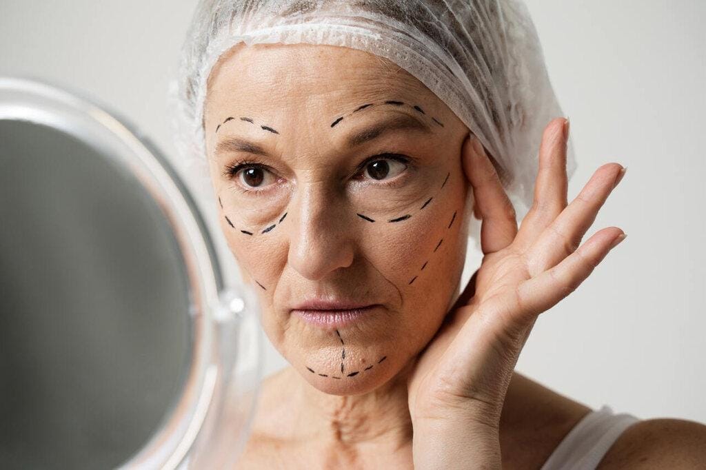 Ritidoplastia ou face lifting: entenda a diferença e descubra qual é ideal para você