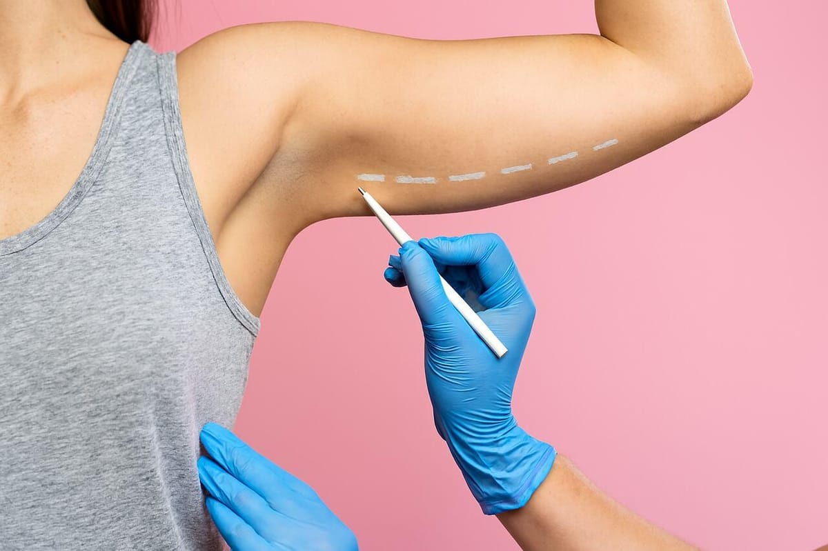 Lipo no Braço: a solução para a flacidez e acúmulo de gordura