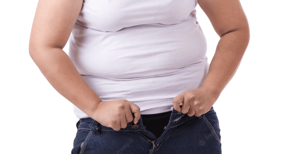 Lipoaspiração com Sobrepeso: Posso Fazer? Entenda os Critérios de Segurança e Limites Técnicos