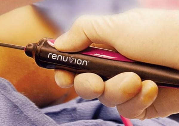 Renuvion: guia completo sobre o tratamento para flacidez