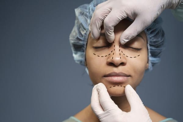 Nariz de batata: como corrigir com a rinoplastia