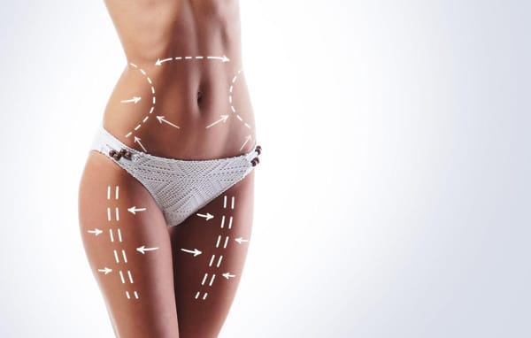 Lipo HD: tudo sobre o procedimento e seus custos