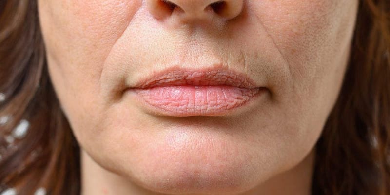 Bigode chinês: entenda o que é e como evitá-lo!
