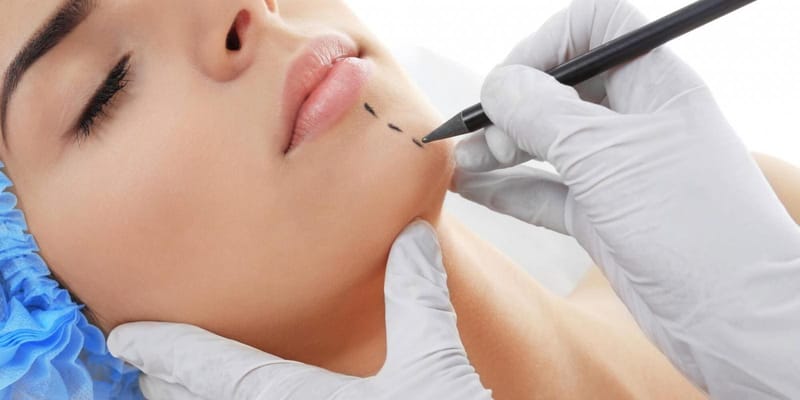 Conheça a Mentoplastia, cirurgia para aumentar ou diminuir o queixo