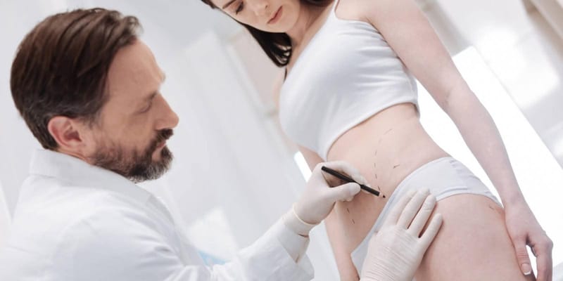 Dermolipectomia: entenda tudo sobre esse tipo de cirurgia