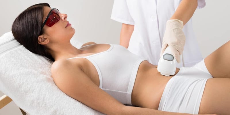 Quer saber como acabar com as estrias? Conheça os tratamentos mais indicados!