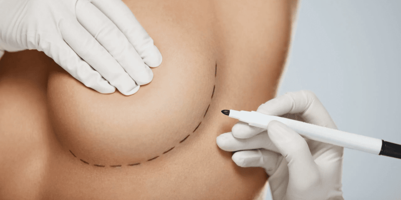 Qual o tipo de mama mais procurado pelas mulheres?