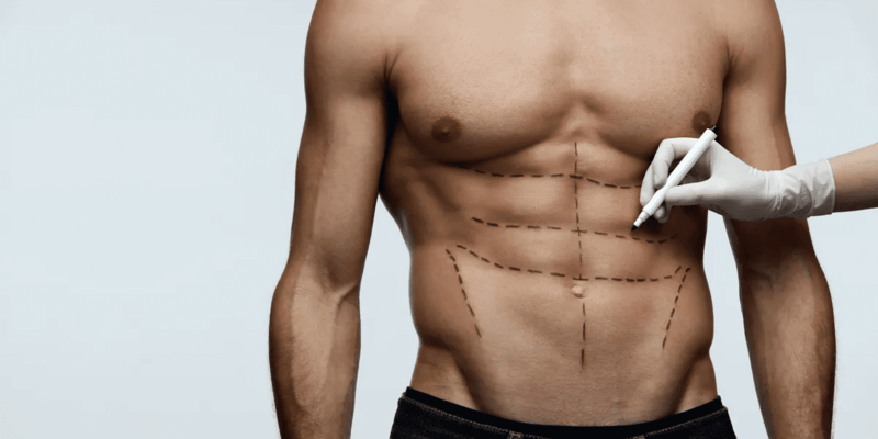 Toda Lipo HD gera o mesmo resultado? O que influencia no resultado? 