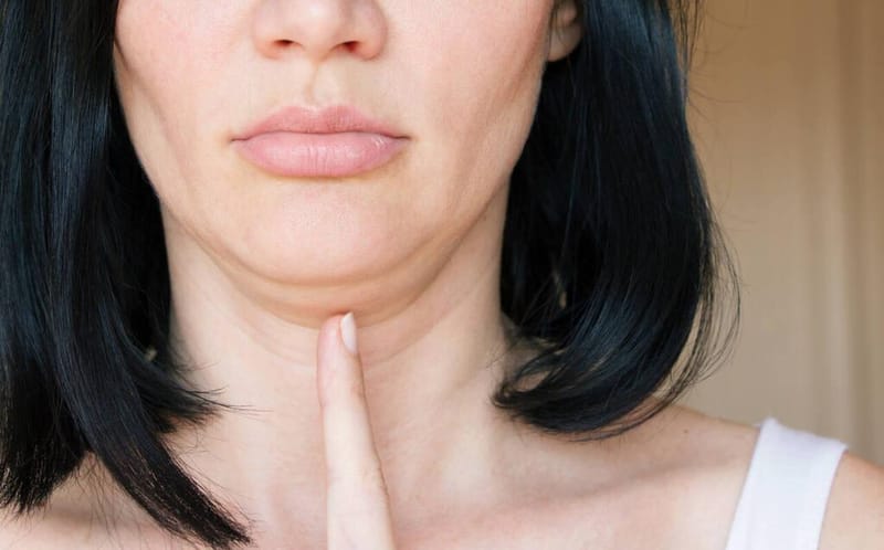 Lipo de Papada: o que é, como funciona e cuidados essenciais