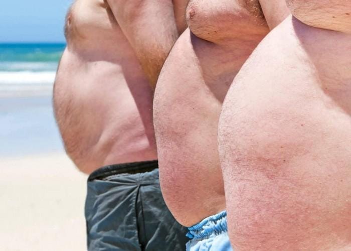 Cirurgia de Ginecomastia na Clínica SER