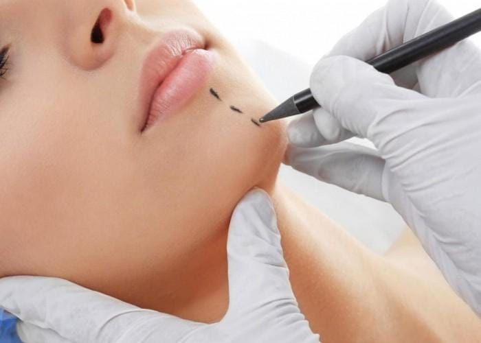 Mentoplastia na Clínica SER Cirurgia Plástica em São Paulo