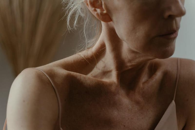Deep Neck Lift com Dr. Carlos Camilo em São Paulo - SP: conheça a cirurgia plástica no pescoço com resultado natural