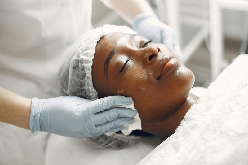 Lip Lift: saiba o que é, como é feito e resultados
