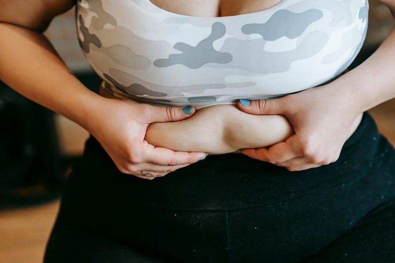 Lipedema na barriga: Causas, Sintomas e Tratamento