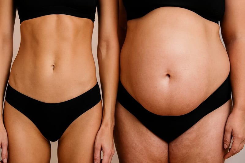 Entenda sobre a lipo na barriga e a transformação do seu abdômen