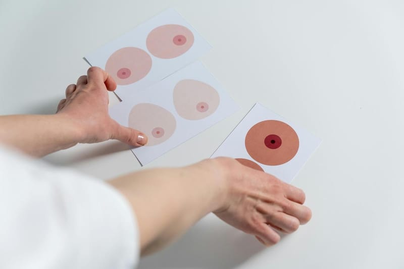 Mamilos: conheça diferentes tipos e impactos na saúde e estética